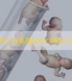 3类人群不能服用?喝红花四物汤需要注意哪些禁忌?