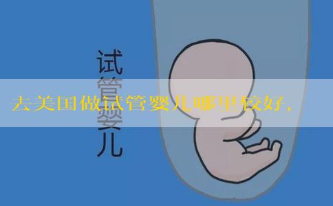 去美国做试管婴儿哪里较好，大约需要多少钱！