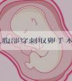 为什么腹部穿刺取卵手术中打过麻药的人都后悔了？