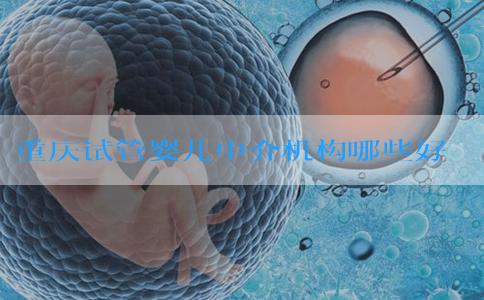 重庆试管婴儿中介机构哪些好-重庆试管婴儿收费标准！