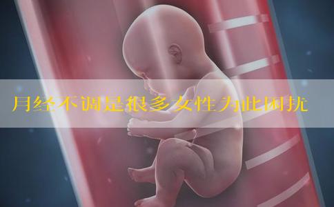 月经不调是很多女性为此困扰不已的问题 月经不调是怎么回事？
